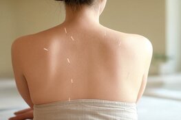 Acupunctuur als effectieve behandelwijze voor uiteenlopende klachten